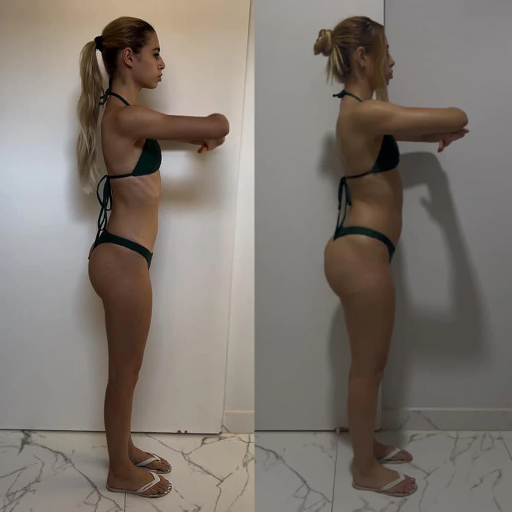 Transformação corporal case de sucesso 12 - antes e depois