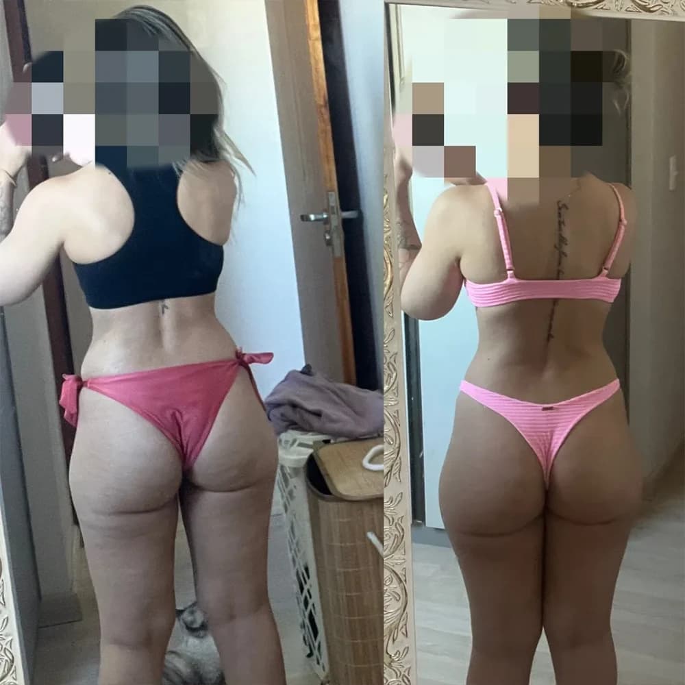 Transformação corporal case de sucesso 7 - antes e depois